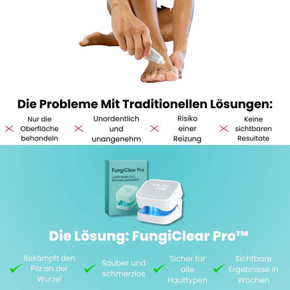 FungiClear Pro™ | Klare, Gesund Aussehende Nägel Zu Hause Wiederherstellen