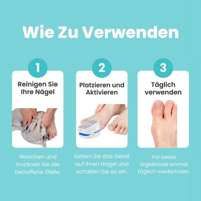 FungiClear Pro™ | Klare, Gesund Aussehende Nägel Zu Hause Wiederherstellen